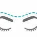 Non Surgical Browlift