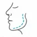 Facial Contouring